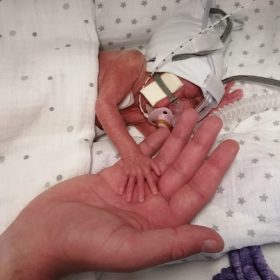 Providing emotional support to a mother after a traumatic birth thumbnail