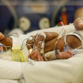Neonatal care and support – the challenges of piloting a new service